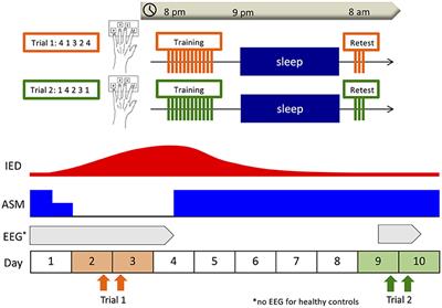 The effect of interictal epileptic discharges and following spindles on motor sequence learning in epilepsy patients